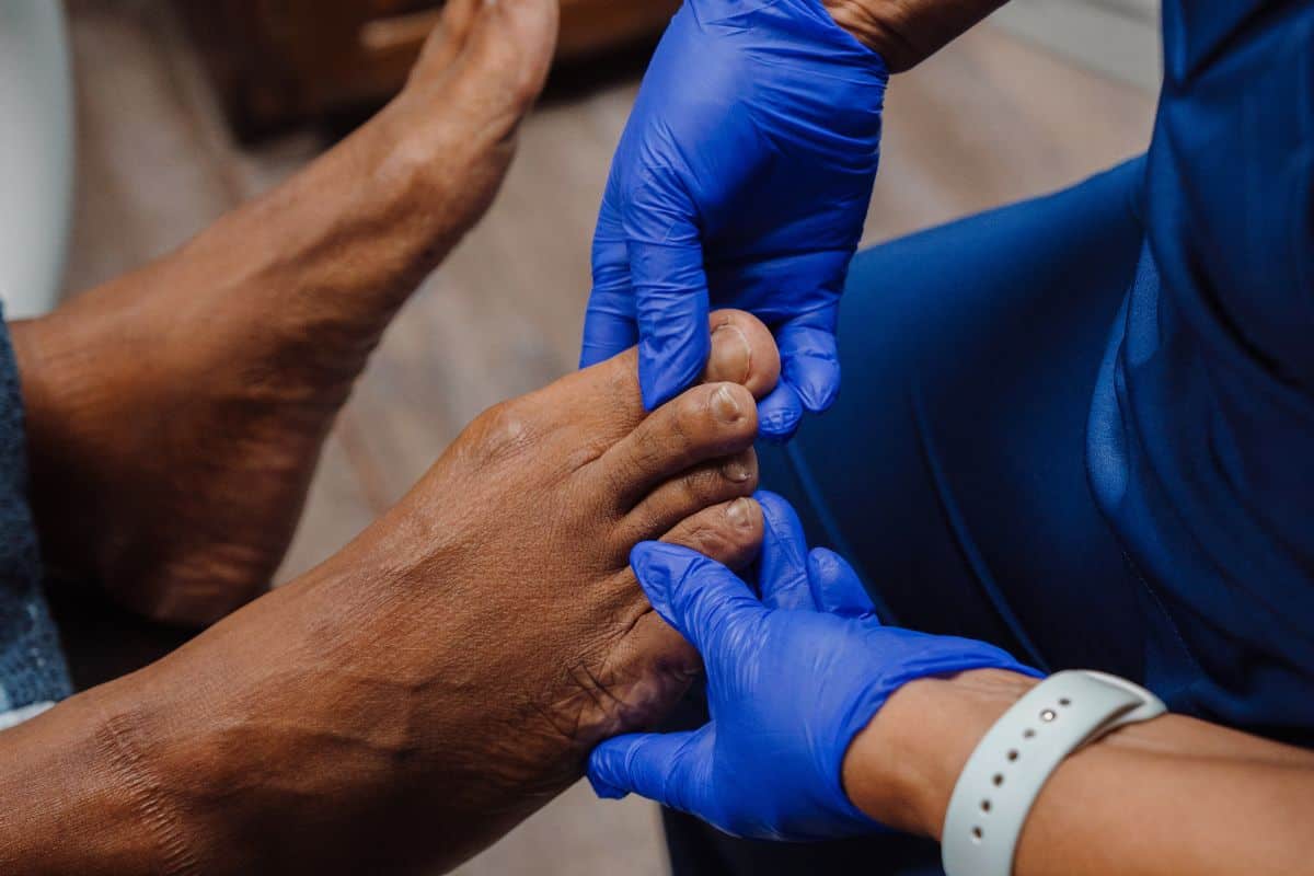 signs a diabetic foot wound needs immediate care