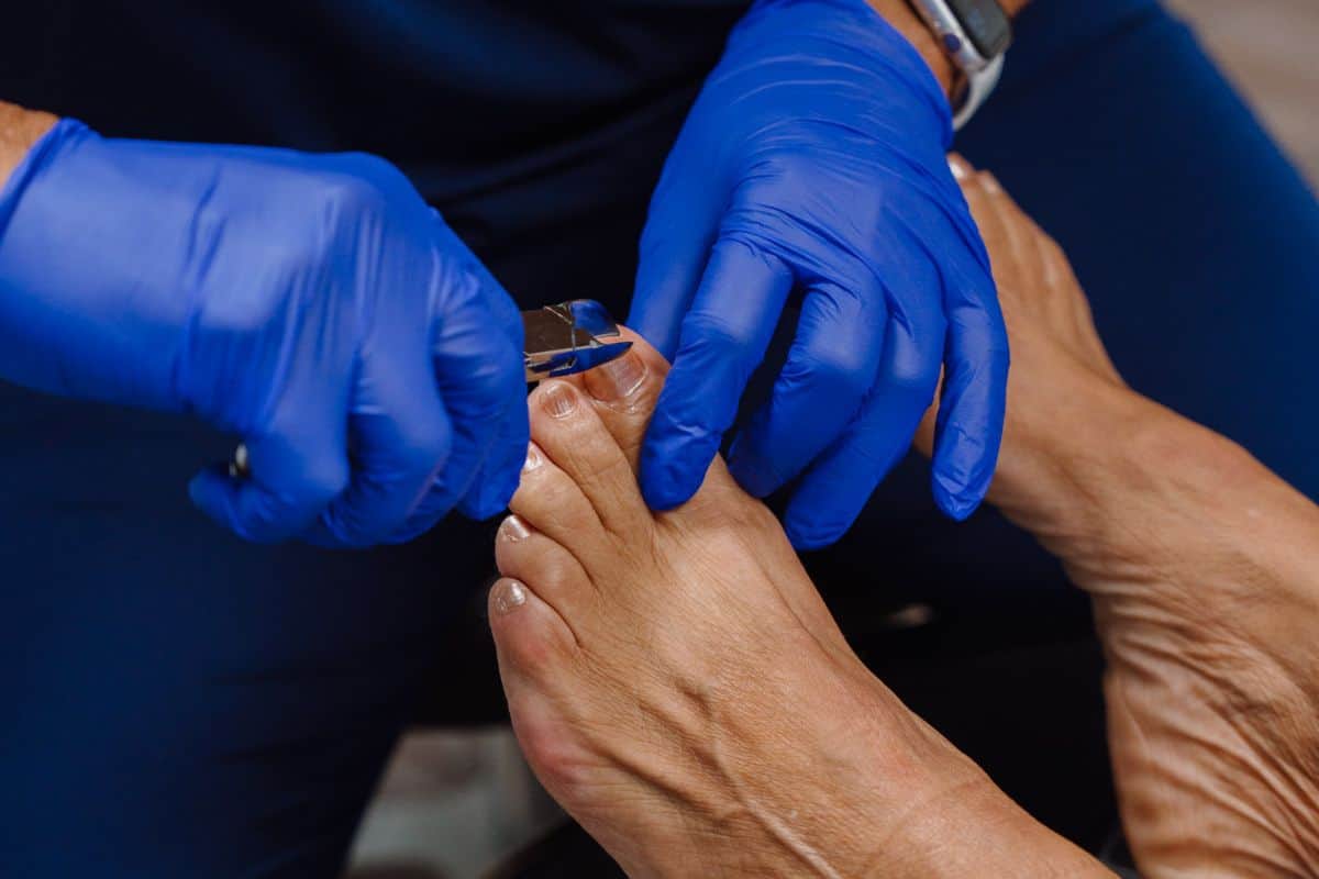 Why diabetics need medical nail care